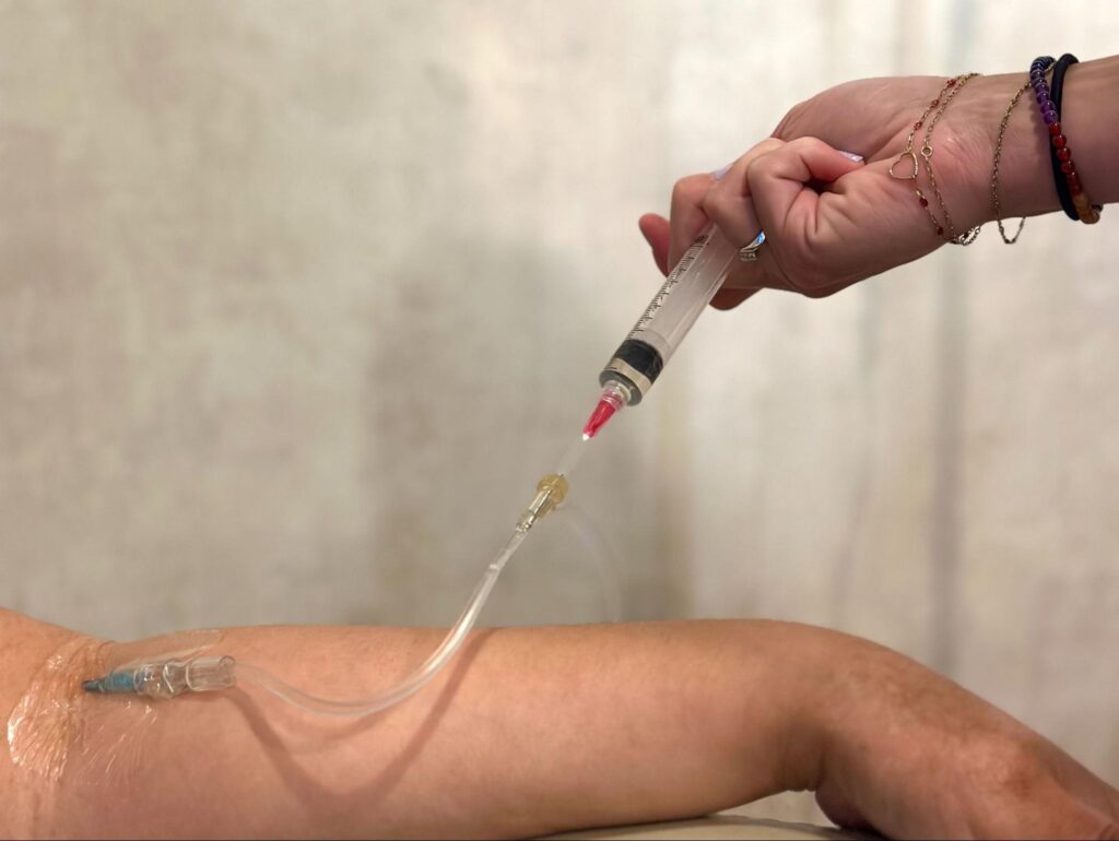 IV Elements nurse administering ozone therapy to client. 