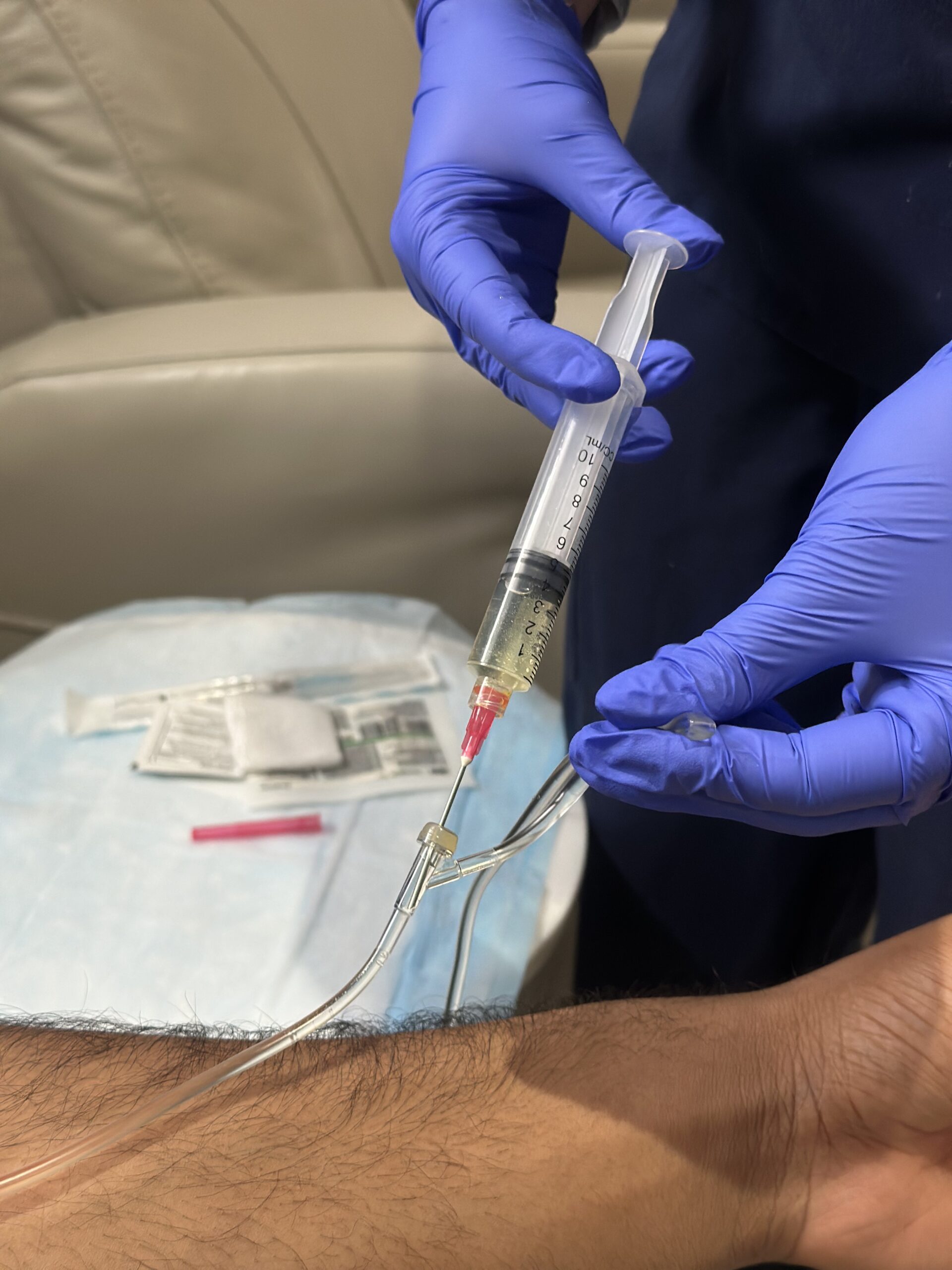 Nurse pushing glutathione into IV