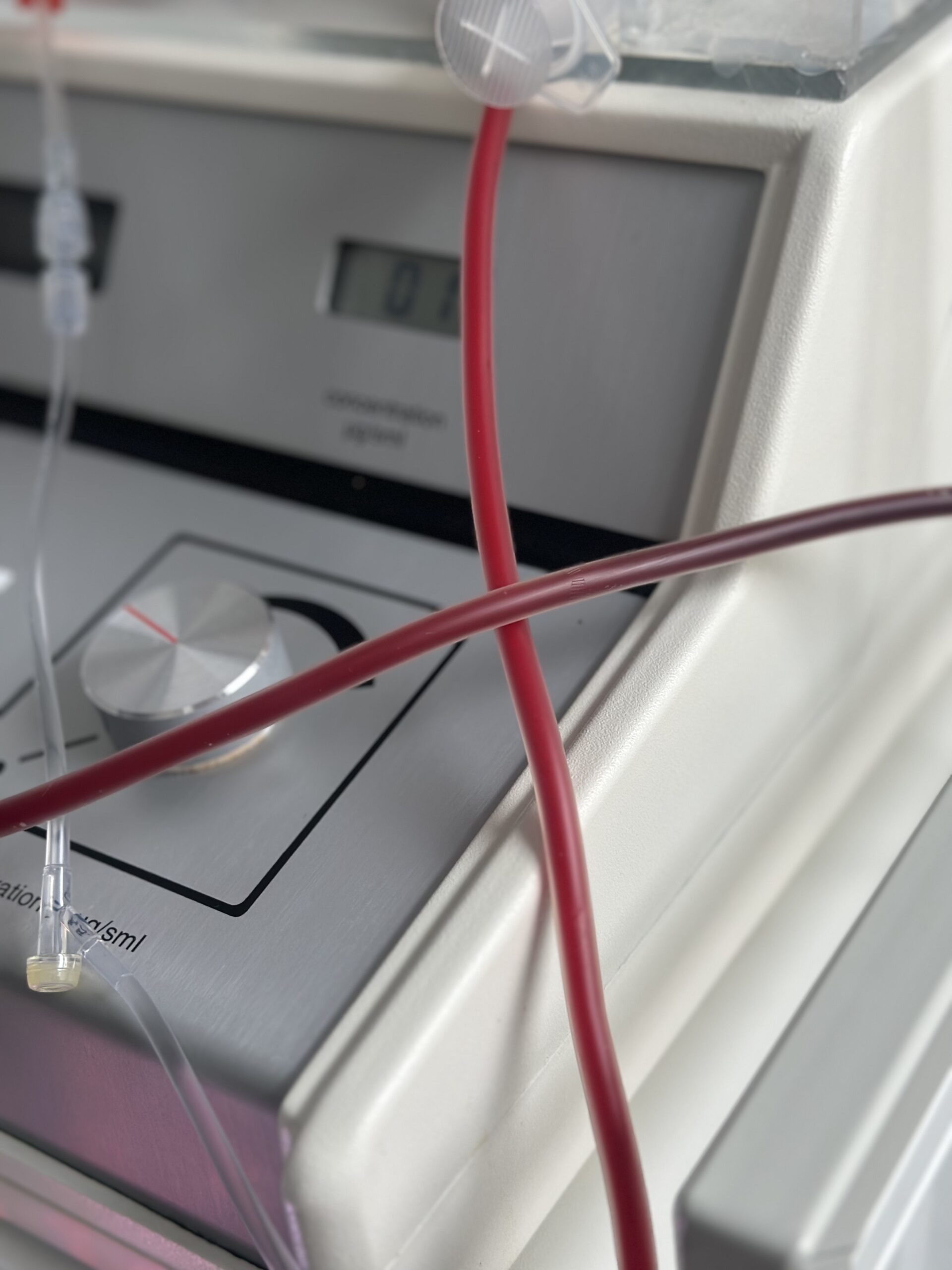 EBOO machine IV lines showing darker blood entering and brighter oxygenated blood going back into the body